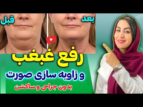 بهترین روش برای از بین بردن غبغب بدون نیاز به جراحی مزوتراپی لیپوماتیک و