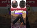 yoga for hair growth 💹💯💯 #shortsfeed #healthtips #hairgrowth #healthylifestyle #ytshorts