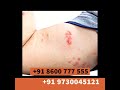 SBL world class Homeopathy - Shivam Homeopathy - 918600777555