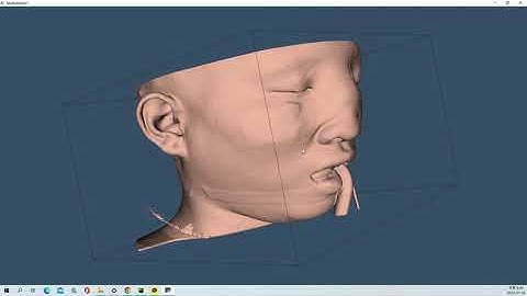 VTK Python Example - MedicalDemo1