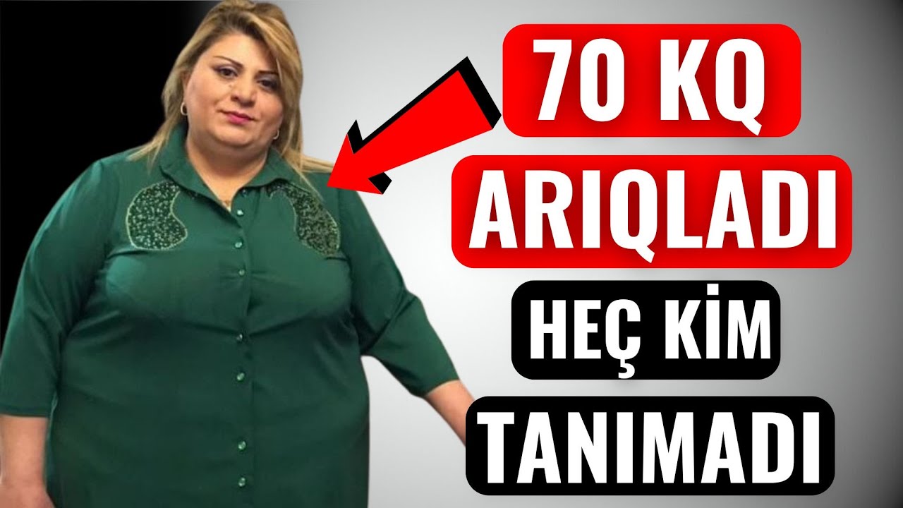 Azərbaycanlı Qadın 70 kiloqram ARIQLADI - Heç kəs onu tanıya bilmədi