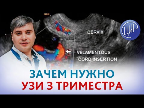 УЗИ 3 триместра. Зачем нужно делать УЗИ на поздних сроках беременности. Курганников А.С.