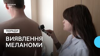 Меланома - що варто знати та коли слід перевіряти: поради волинського лікаря