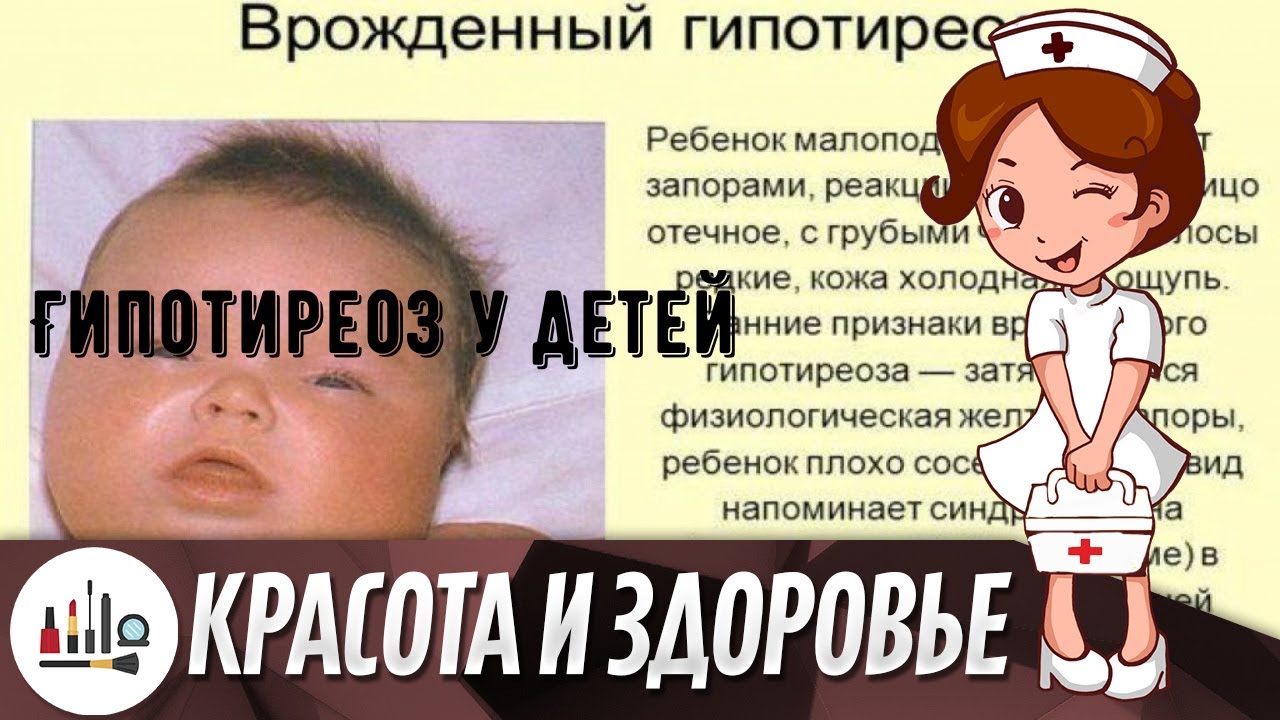 Гипотиреоз у детей