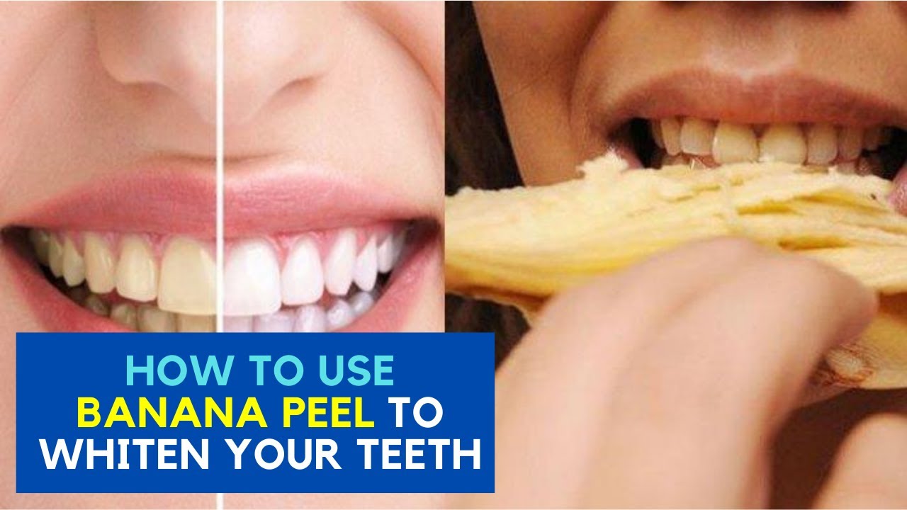 How to Use Banana Peel to Whiten Your TeethYT YouTube