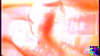 Not Sure What I Did To Коллекция Заставок От Нтв - Дизайн Ntv - Design Collection 10