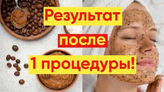 АНТИВОЗРАСТНАЯ МАСКА ОМОЛАЖИВАЮЩАЯ И ТОНИЗИРУЮЩАЯ!