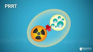 Peptide Receptor Radionuclide Therapy Prrt Explainer V2