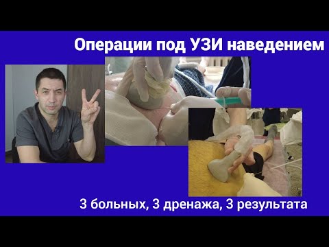 Видео: Как пишется чрезкожно?