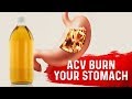 Does Apple Cider Vinegar Burn Your Stomach?: Dr.Berg