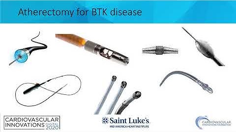 BTK Solutions- Matthew Bunte, MD