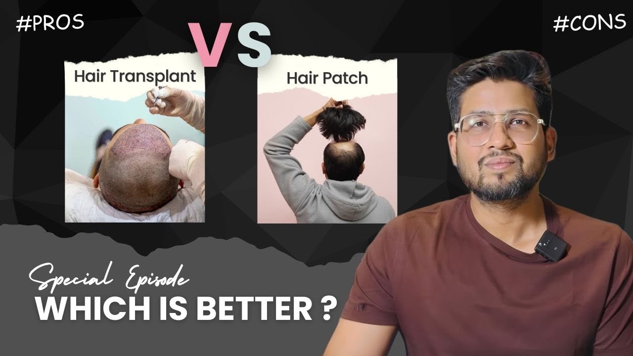 Hair Transplant Vs Hair Patch | Pros & Cons |Berkowits