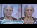 HIFU: Lifting Facial - Tratamiento Tensor - Rejuvenecimiento Facial