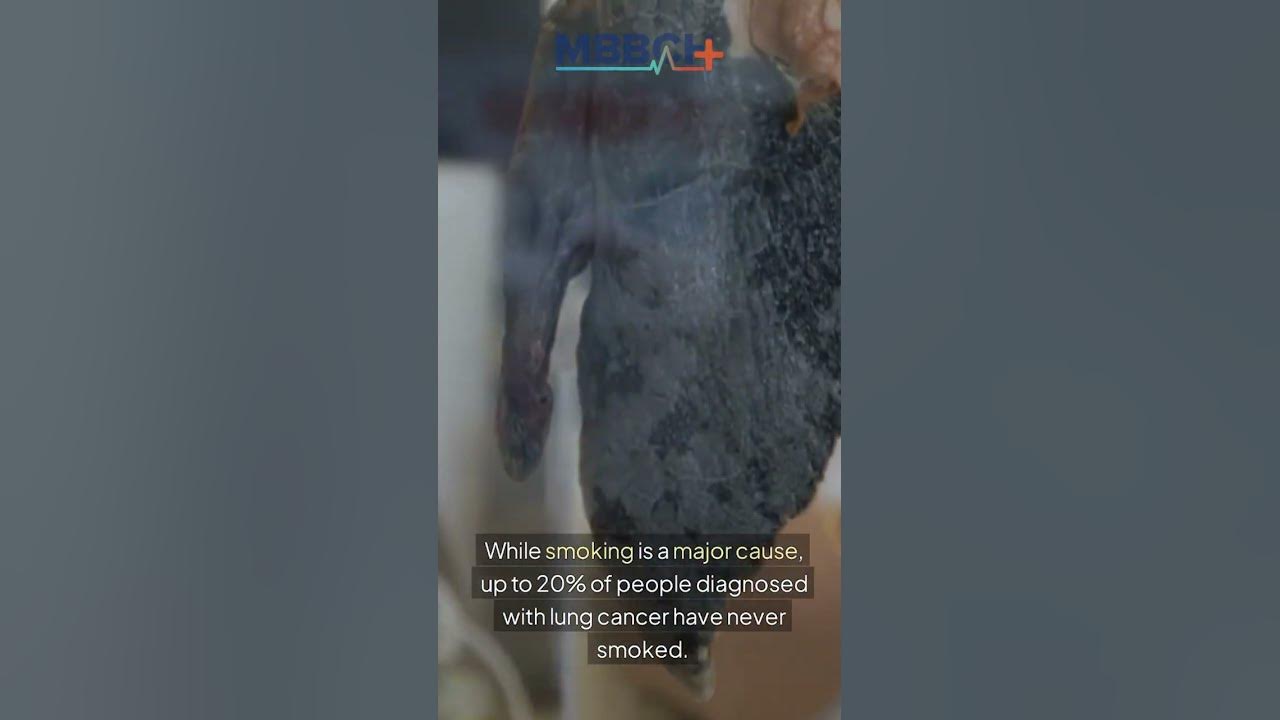 Do Only Smokers Get Lung Cancer