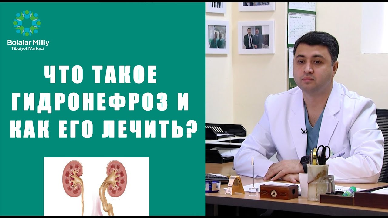 Что такое ГИДРОНЕФРОЗ и как его лечить?