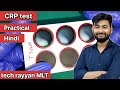 CRP test practical guide||#labtechnician #dmlt #rayyansir