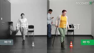 Before/After recoveriX - MS - TUG - MS6