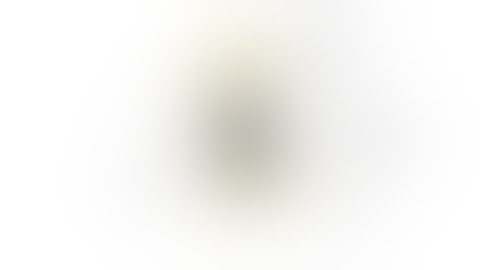 Patient-Specific 3D-Printed aMace Hip Implant | Acetabular Revision System | Materialise Medical