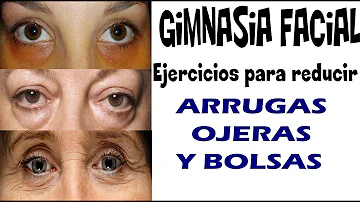 ¿El ejercicio mejora las ojeras?