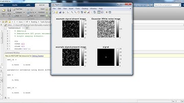 Implementing on Hotelling Observer in MATLAB | +91-9872993883 for query