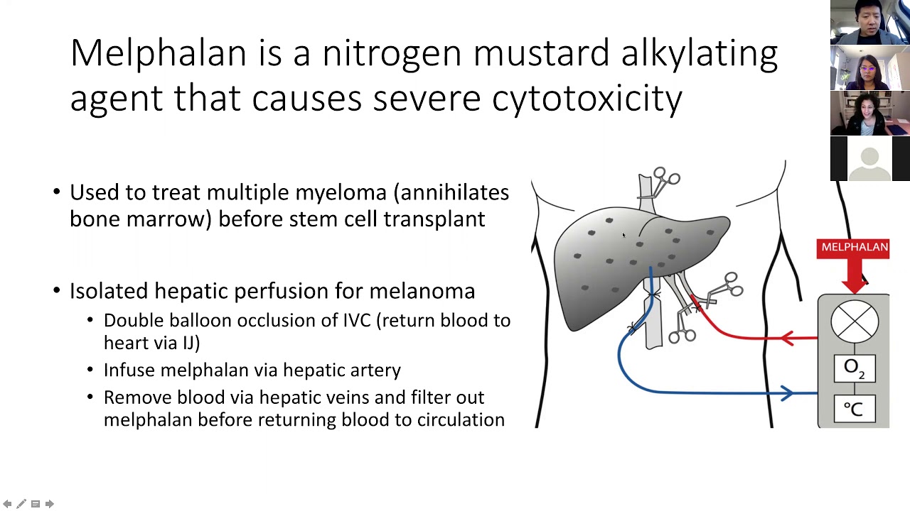Treating melanoma mets with Melphalan hepatic perfusion- a novel IR ...