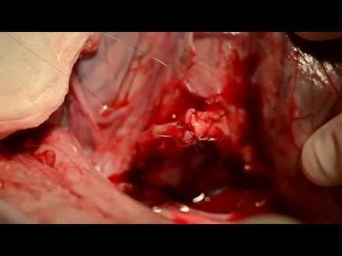 Videó: Ureter Kövek Kutyákban