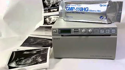 How to clean the printer head for ultrasound thermal video printer 02