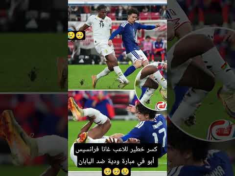 كسر خطير للاعب غانا فرانسيس أبو في مبارة ودية ضد اليابان مما سيبعده عن كأس إفريقيا وكأس العالم