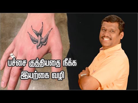 பச்சை குத்தியதை நீக்க இயற்கை வழி - Healer Baskar