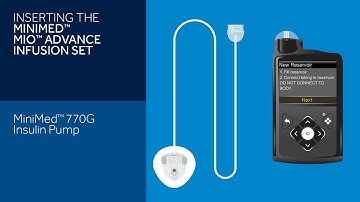 Inserting the Mio Advance Infusion Set with the MiniMed™ 770G System