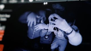 Screamfrmttb X Scrapp - Face Lyft Official Music Video S&E By