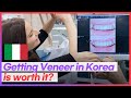 Dental Laminate or Veneers Result in Korea Seoul l Yonsei Uline Dental Clinic