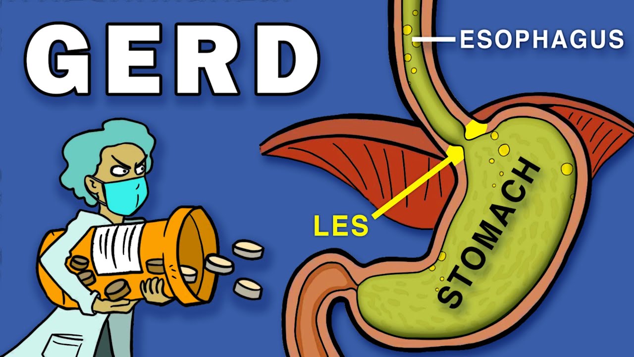 What is GERD?