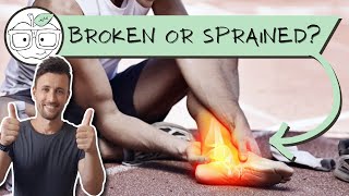 Is Your Ankle Broken or Sprained? Ottawa Ankle Rules screenshot 4