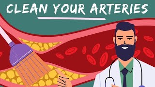 7 Foods That Clean Arteries & Prevent Heart Attacks Naturally 🔥 Dr. William Li's Advice