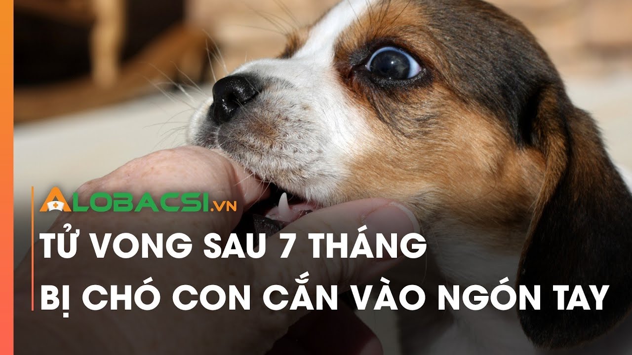T.ử v.o.ng sau 7 tháng bị chó con cắn vào ngón tay - YouTube