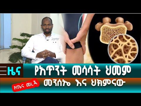 ቪዲዮ: የአጥንት ስፓርስን ለማከም 3 መንገዶች