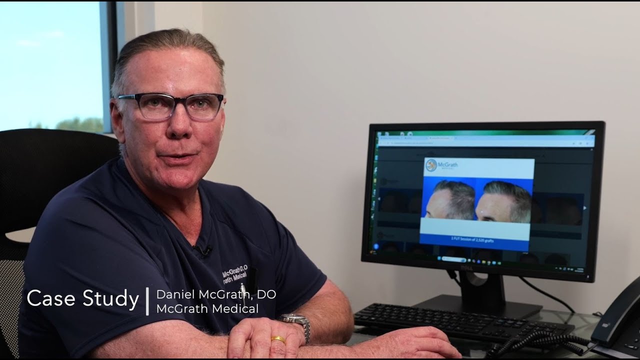 Hair Transplant Patient Hairline Restoration Case Study | Austin, Texas