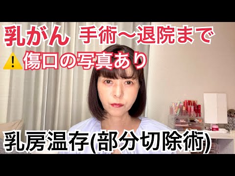 【ステージ1の乳がんの手術〜退院まで】部分切除の写真。傷口。