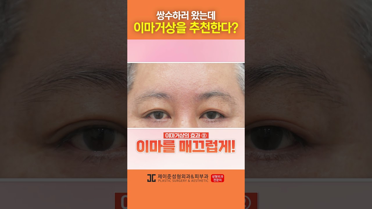 [Thẩm mỹ viện da liễu Jayjun] Đôi mắt mệt mỏi của bạn có thể trở nên tươi sáng hơn! #shorts