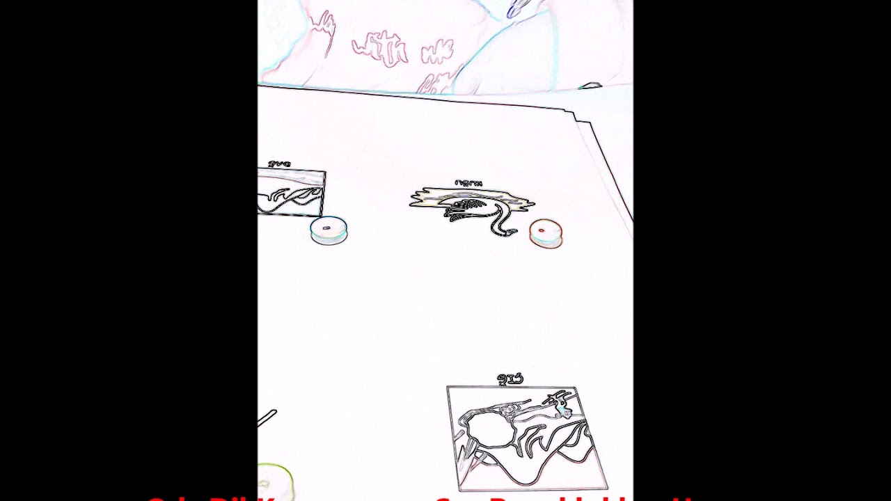 ÇOCUKLUK ÇAĞI APRAKSİSİ TERAPİ