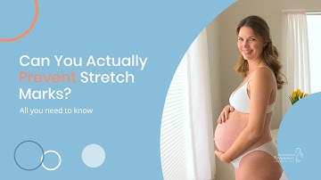 Can You Actually Prevent Stretch Marks?