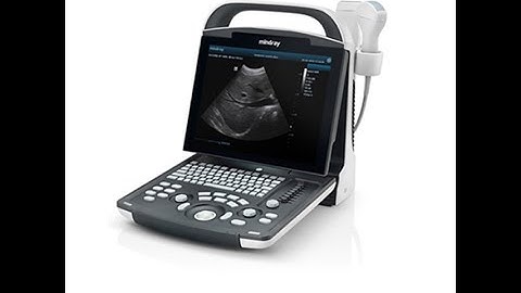 mindray dp 10 ultrasound