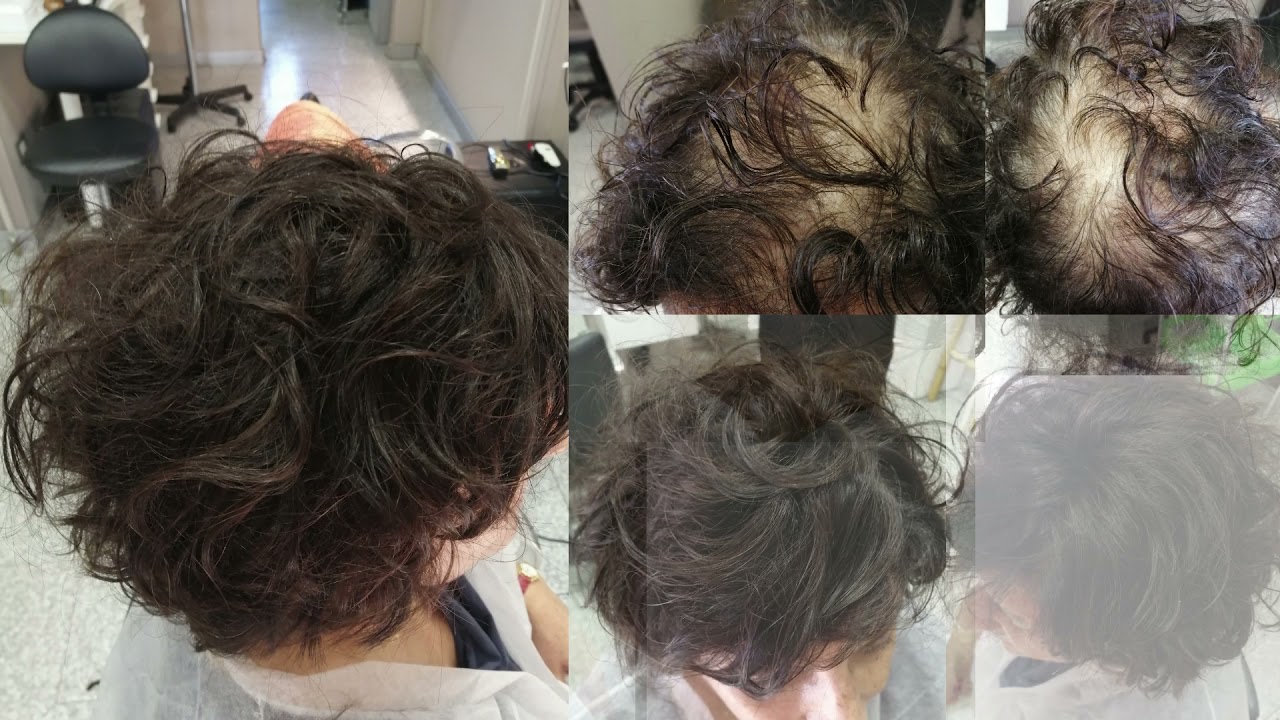 3 TIPI DIVERSI DI MICROLINEA.