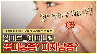 딱딱한 여드름? 뾰루지? 🤷‍♀️헷갈려서 짜면 큰일 나는 💀표피낭종💀 - [언니네피부과]