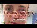 Развитие флюса | ПЕРИОСТИТ ВЕРХНЕЙ ЧЕЛЮСТИ