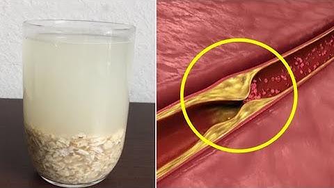 血管堵塞嚴重？它是疏通血管 「 高手」，打通血管阻塞，讓血管暢通無阻，血栓悄悄不見了！ - 天天要聞