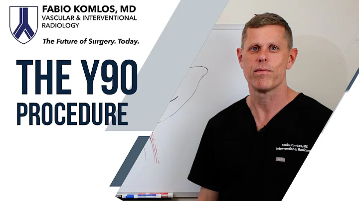 What is Y90 Radioembolization? How can you kill cancer without surgery.