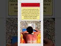 Sunburn ko 5 min me thanda karein,Kaccha doodh ka magic.#SunburnRelief #HomeRemedy #KacchaDoodh #new