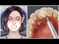 [ASMR] 누렇고 딱딱한 치석 제거 / tartar removal animation / teeth scaling